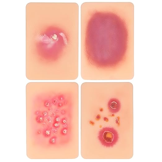 Wound Packing Trainer, Bacterial Infected Wound Model, Palm Sized Wound Simulation Models for Medical Education, Wound Care Demonstrations Tool, 4PCS