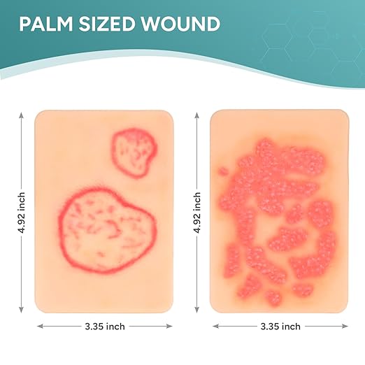 Wound Packing Trainer,Fungal Infection Wound Model, Palm Sized Wound Simulation Models for Medical Education, Wound Care Demonstrations Tool, 2PCS