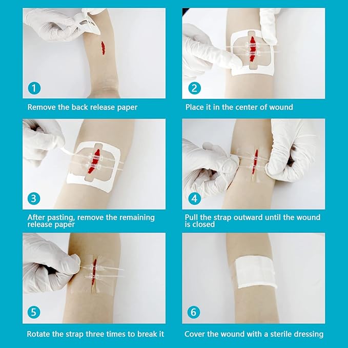 Emergency Wound Closure Strips Zip Stitch Sutures Kit, 2 Pcs Zipstitch Butterfly Bandages Laceration Closure Kit, Quick Clot Wound Closure Device for Wound Care