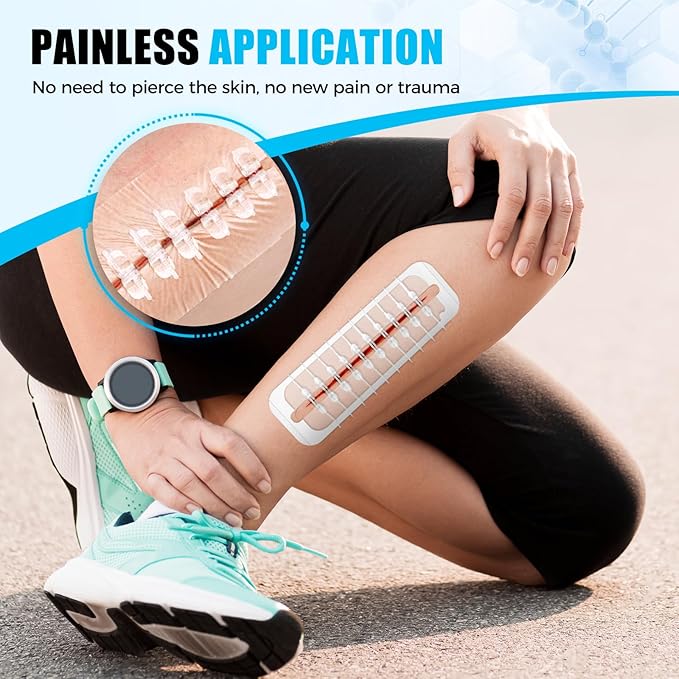 Large Butterfly Bandages for Extra Large Wounds | Steri Strips Wound Closure - Surgical-Grade Stitchless Laceration Repair & Rapid Hemostasis, Emergency First Aid Care