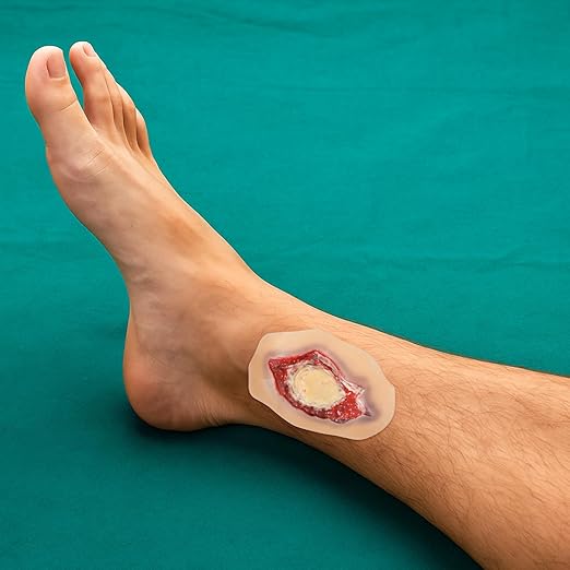 Silicone Ankle Fracture Wound Model, Wearable Moulage Simulation for Medical Training, Self-Adhesive Ankle Injury Simulator with Exposed Bone and Torn Flesh