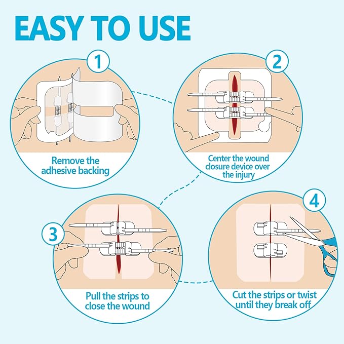 Sutures Butterfly Bandaids - 4 Pcs Laceration Closure Kit - Surgical Laceration Repair Without Sew - Quick Clot -Emergency Wound Closures Device (PU)