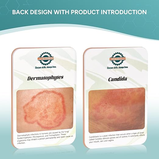 Wound Packing Trainer,Fungal Infection Wound Model, Palm Sized Wound Simulation Models for Medical Education, Wound Care Demonstrations Tool, 2PCS