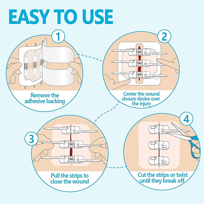 Senvok Butterfly Bandaids with Zip Stitch – 2 Pcs Large Wound Closure Strips for Big Wound Care, Quick Clot Emergency Repair, Hospital-Grade Skin Closure for Home & Outdoor Use