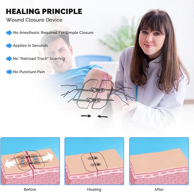 Emergency Wound Closure Strips Zip Stitch Sutures Kit, 2 Pcs Zipstitch Butterfly Bandages Laceration Closure Kit, Quick Clot Wound Closure Device for Wound Care