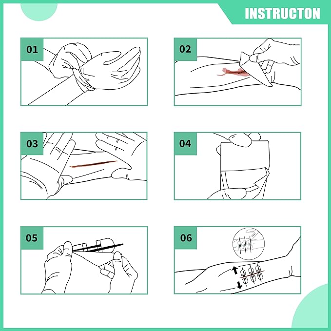RHINO RESCUE Wound Closure Kit, 6pcs with Dresssings, Wound Closure Strips Without Suture, Stitch Zip Laceration Closure Kit for Cut Care, Adhesive Wound Closure Bandages, HSA/FSA Eligible