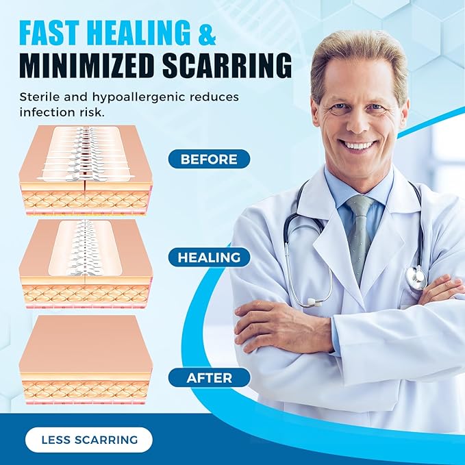 Large Butterfly Bandages for Extra Large Wounds | Steri Strips Wound Closure - Surgical-Grade Stitchless Laceration Repair & Rapid Hemostasis, Emergency First Aid Care