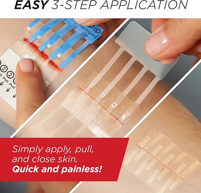Clozex Emergency Laceration Closure & Kit FSA HSA Eligible Skin Closure Device Treat 4 Wounds Combined Up to 5 3/4" Includes Complete Kit to Clean, Close, &Cover Injuries Without Stitches