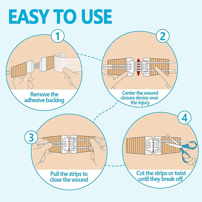 Emergency Wound Closure Kit 2-Pack | Medical Grade Adhesive Sutures | Butterfly Bandages & Clotting Technology | for First Aid Kits, Outdoor Injuries, Post-Surgery Care