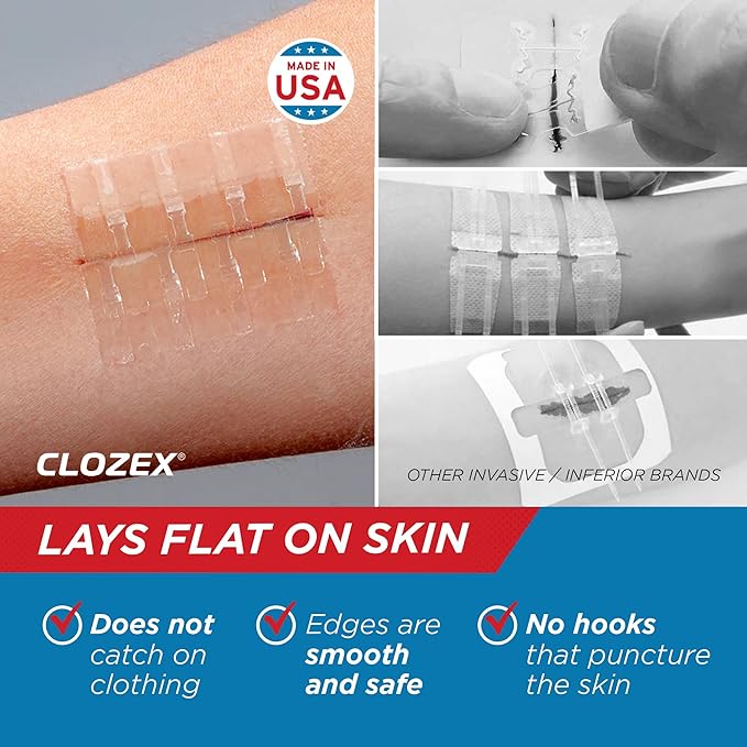 Clozex Emergency Laceration Closure & Kit FSA HSA Eligible Skin Closure Device Treat 4 Wounds Combined Up to 5 3/4" Includes Complete Kit to Clean, Close, &Cover Injuries Without Stitches